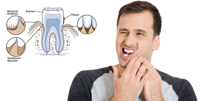 Understanding Teeth Sensitivity