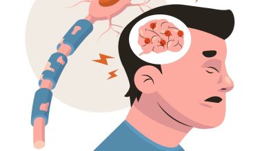 درد نوروپاتیک چگونه به وجود می آید؟