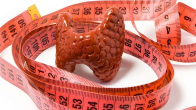 اختلال تیروئید و چاقی